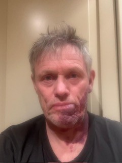 Pål Gunnar Mikkelsplass